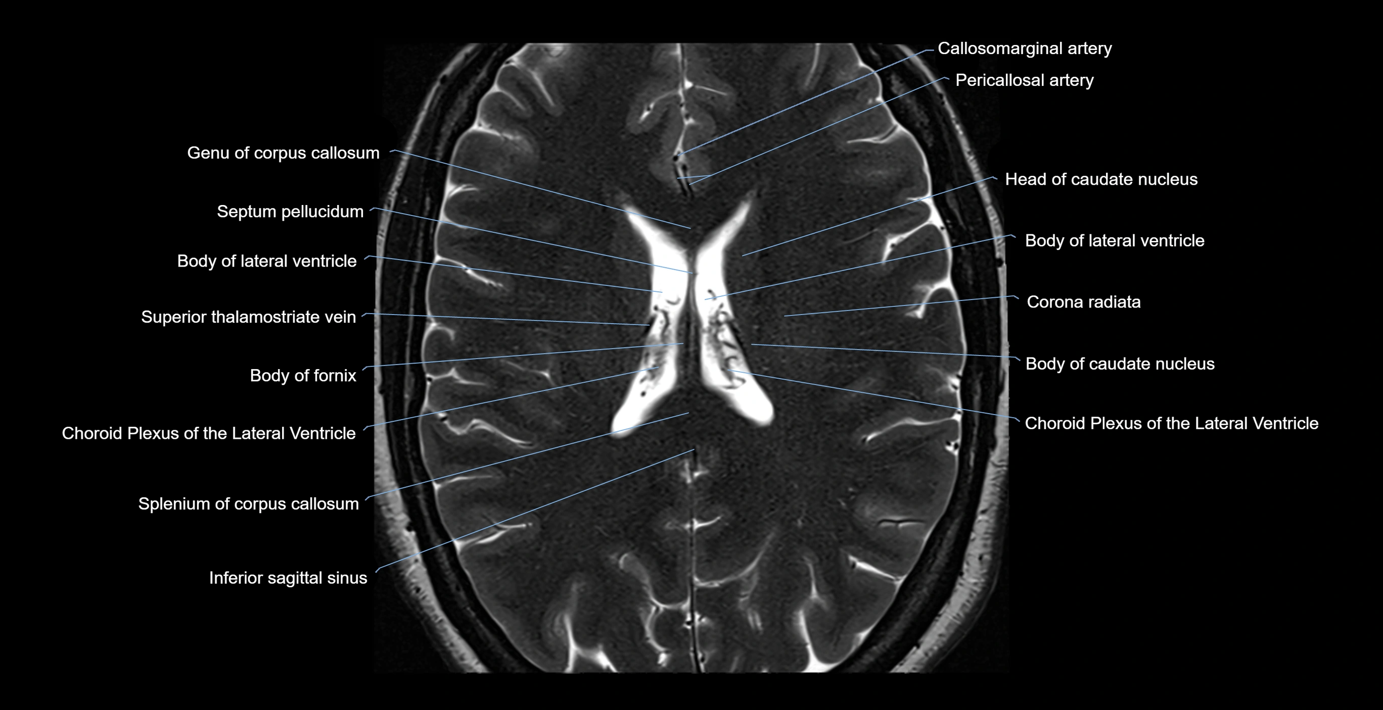 brain axial anatomy 3T MRI images -img-17001-00040.webp